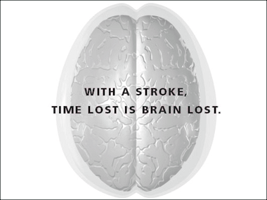 stroke_brain