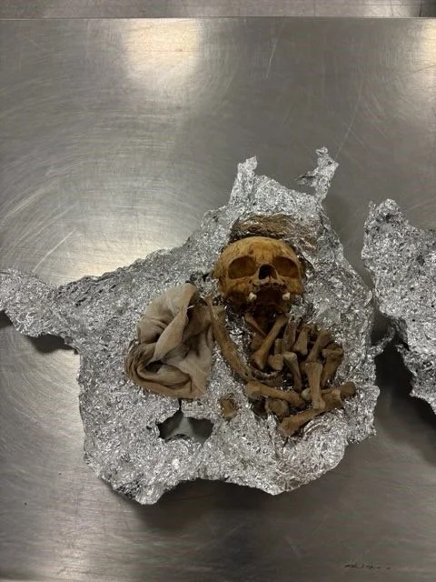 Human skull and bones discovered in passenger’s luggage at Florida airport Human skull and bones discovered in passenger’s luggage at Florida airport