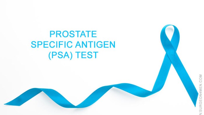 Prostate Specific Antigen (PSA) TestMEC | Best Penile Enlargement ... How much does a psa test cost without insurance