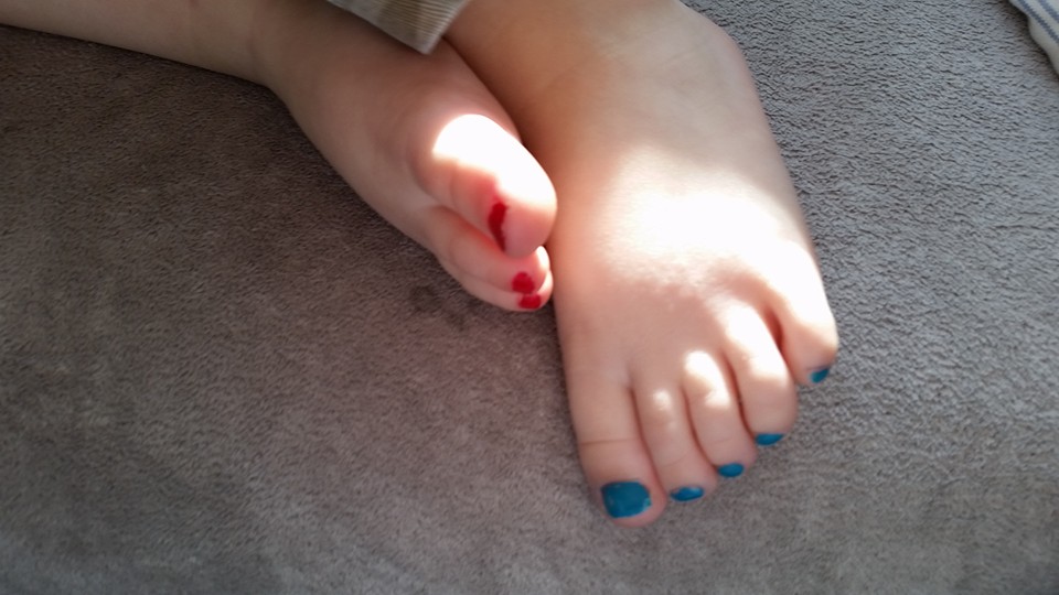 Scopes and Other Uses for Nail Polish