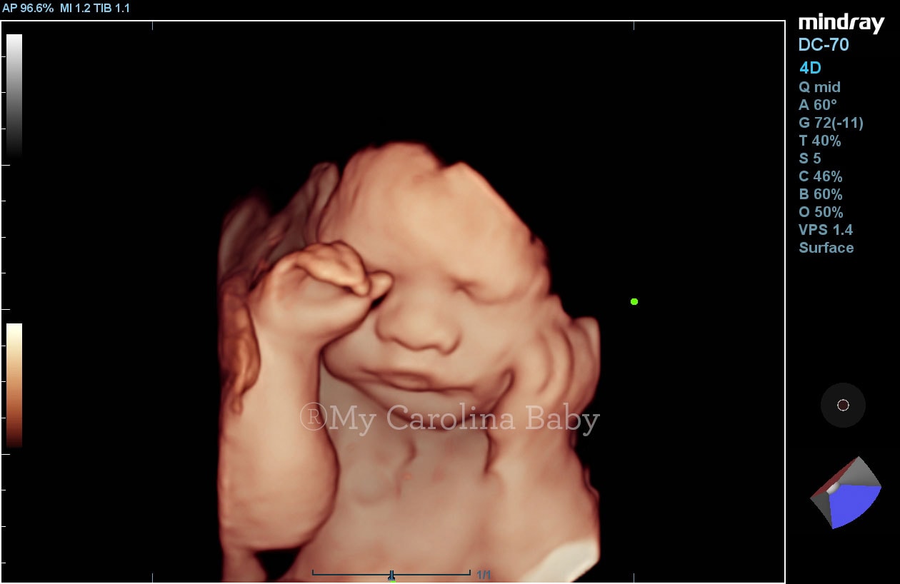 Premier combo ultrasound package
