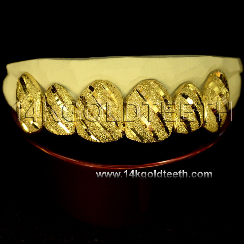 Diamond Dust Yellow Gold Teeth Grillz DD 90001