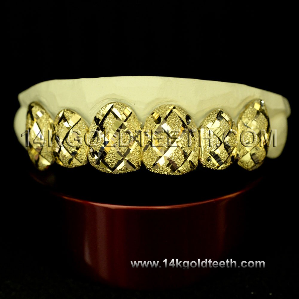 Diamond Dust Yellow Gold Teeth Grillz DD 90007