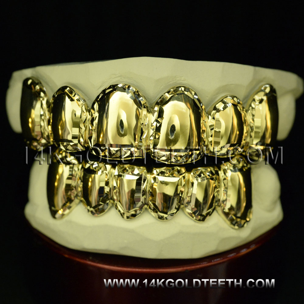 Top & Bottom Yellow Gold Teeth Grillz TBY 30020