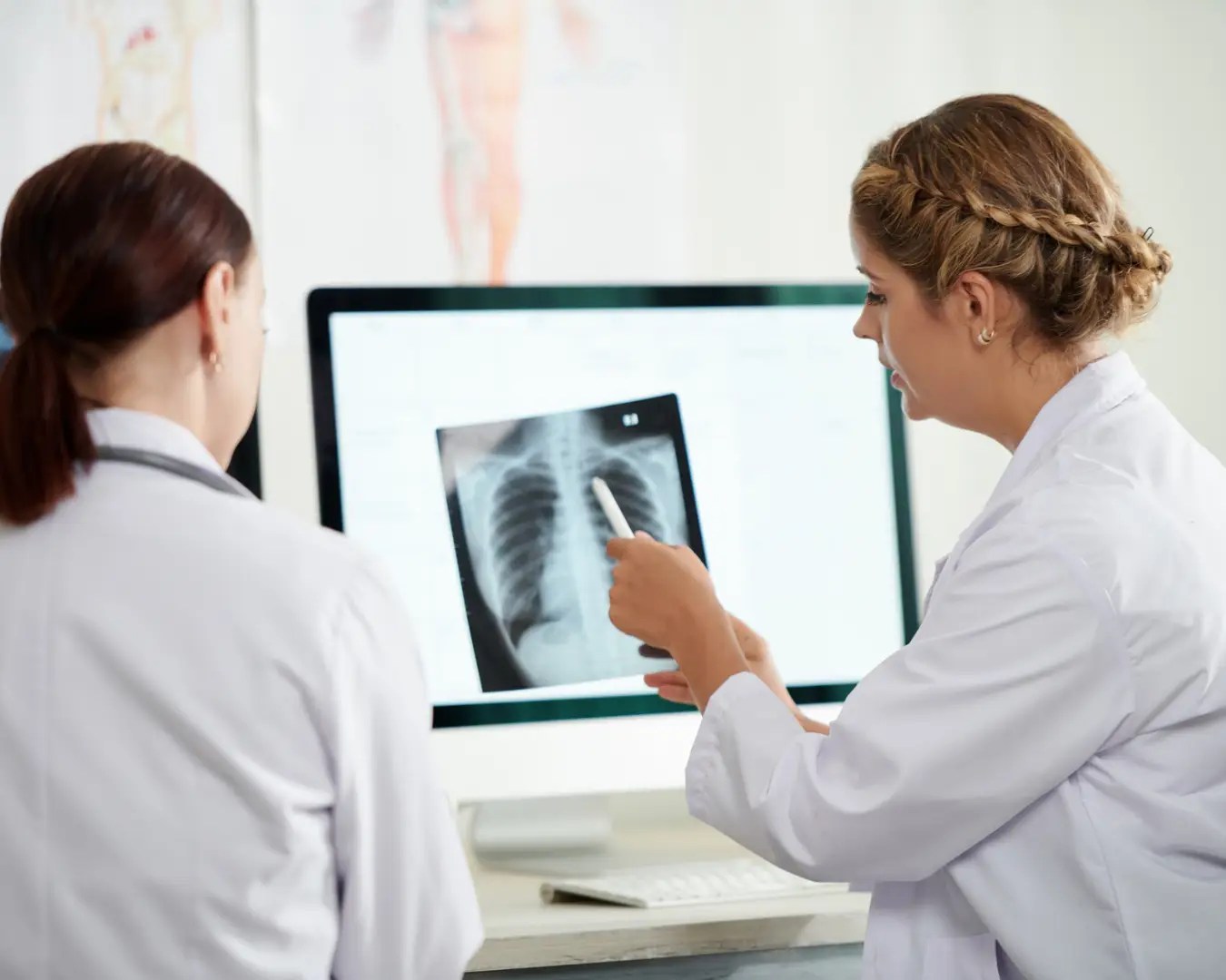 Two young female doctors reviewing e-ray scan of lungs.