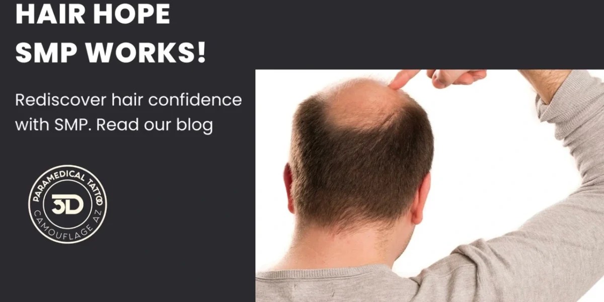 Male hair loss: unveiling the mystery and exploring options
