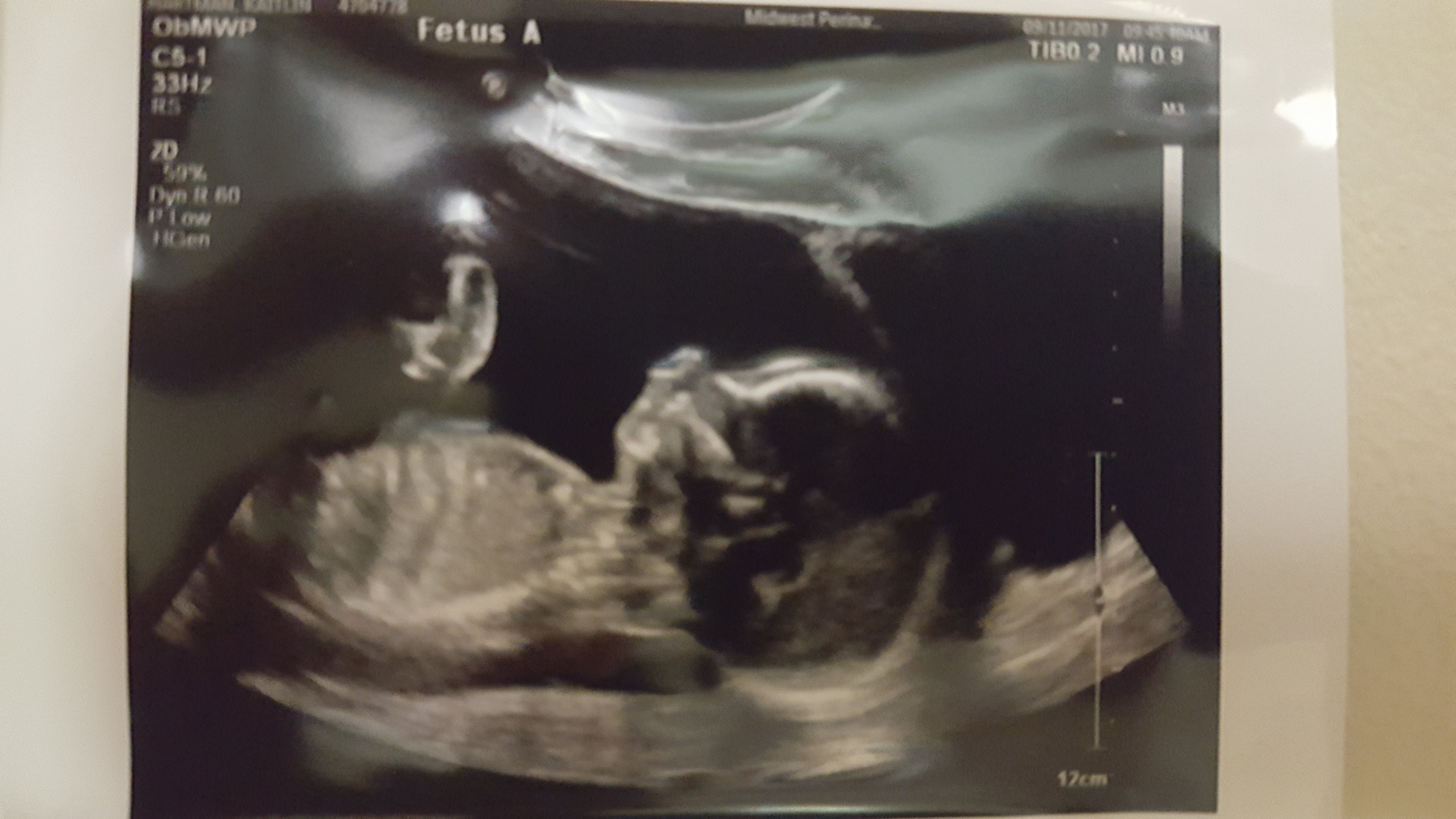 Baby A our big 12 oz girl