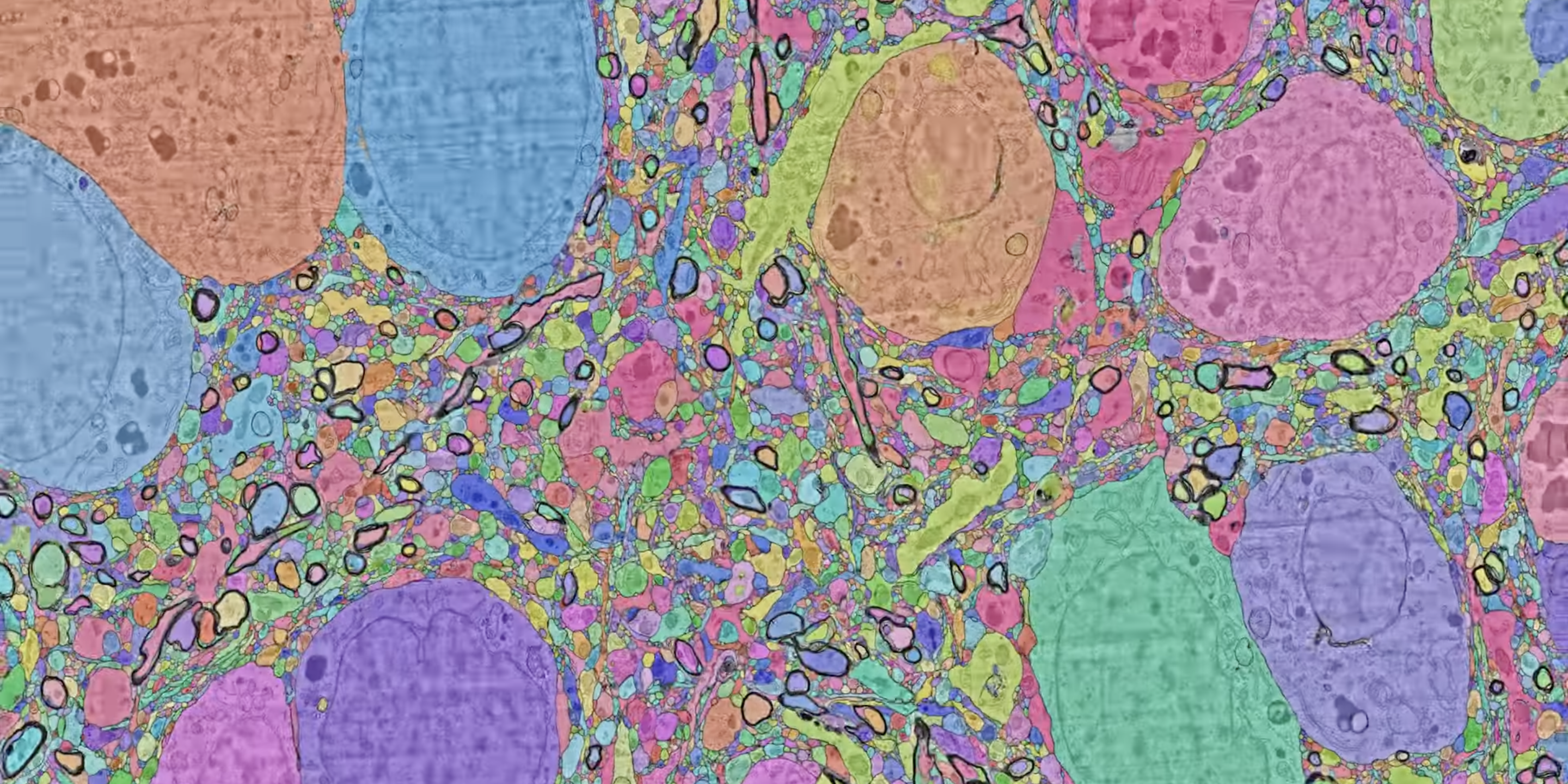 Google helps map one cubic millimeter of human brain tissue - 9to5Google