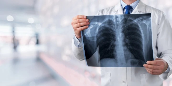Radiography and Medical Imaging