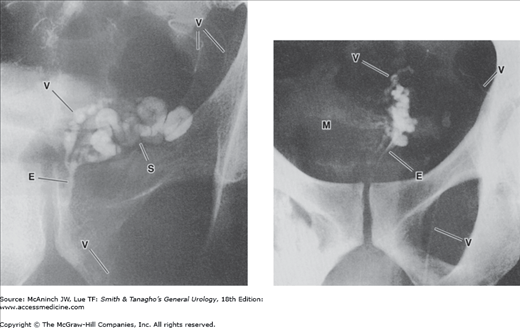 Vasogram m_mcan18_c006f016.png | Abdominal Key