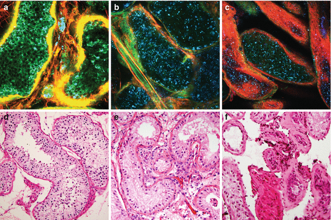 Multiphoton Microscopy in Urologic Surgery | Abdominal Key
