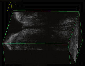 A306046_2_En_19_Figr_HTML.gif