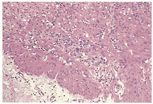 Motility Disorders | Abdominal Key