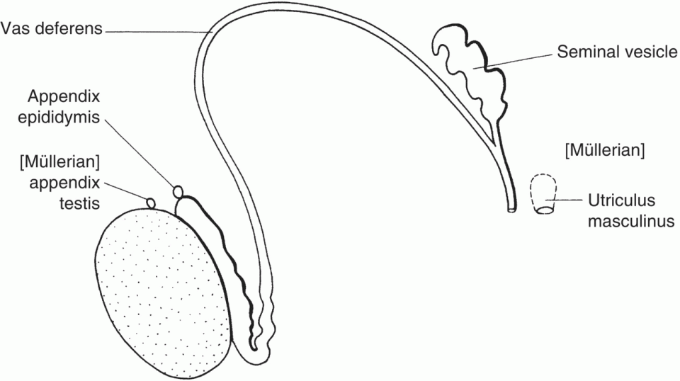 Diagram displaying [Müllerian] appendix testis, appendix epididymis, vas deferens, seminal vesicle, and utriculus masculinus in male.