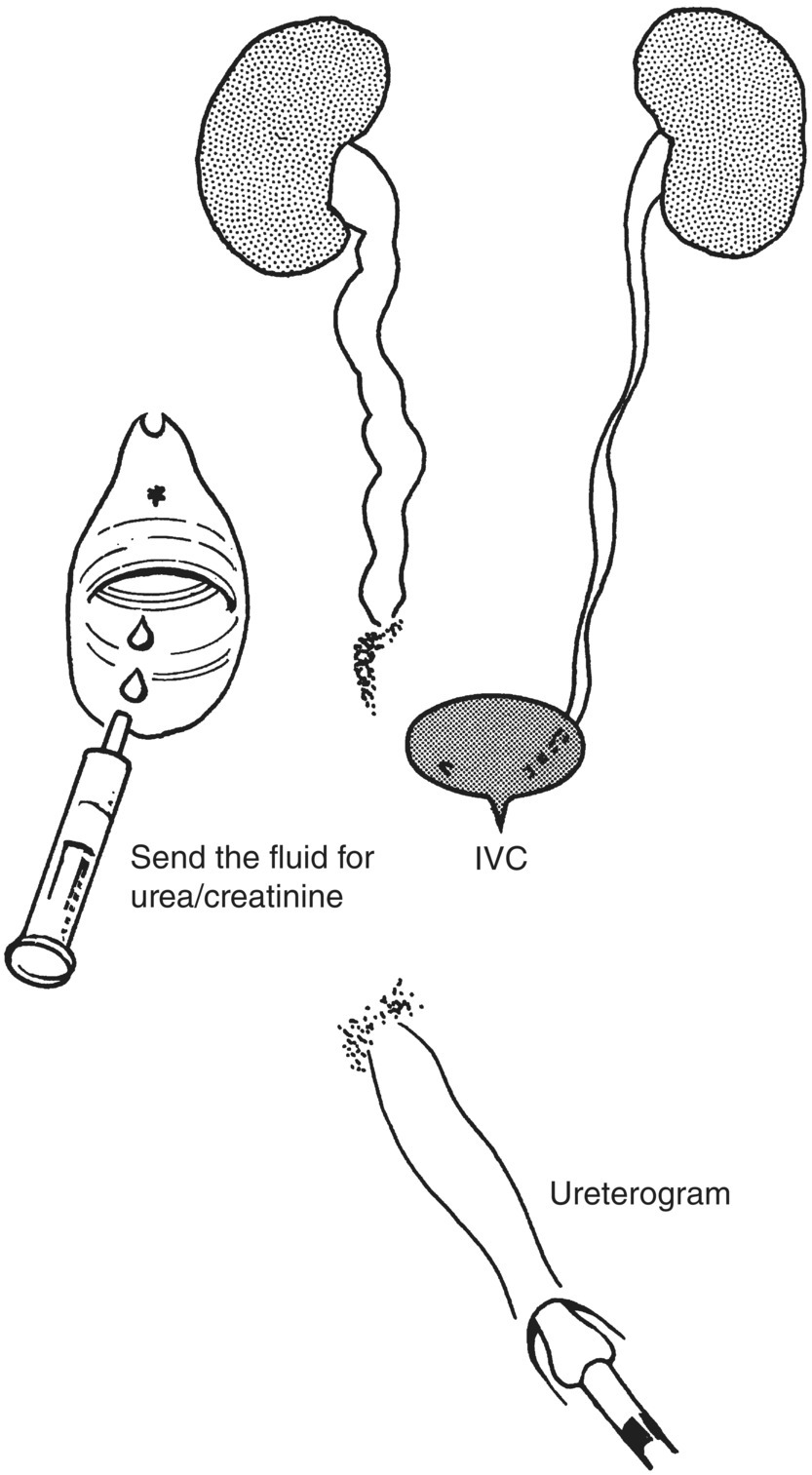 Image described by caption and surrounding text.