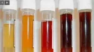 Résultat de recherche d'images pour "La couleur de votre urine révèle votre état de santé"