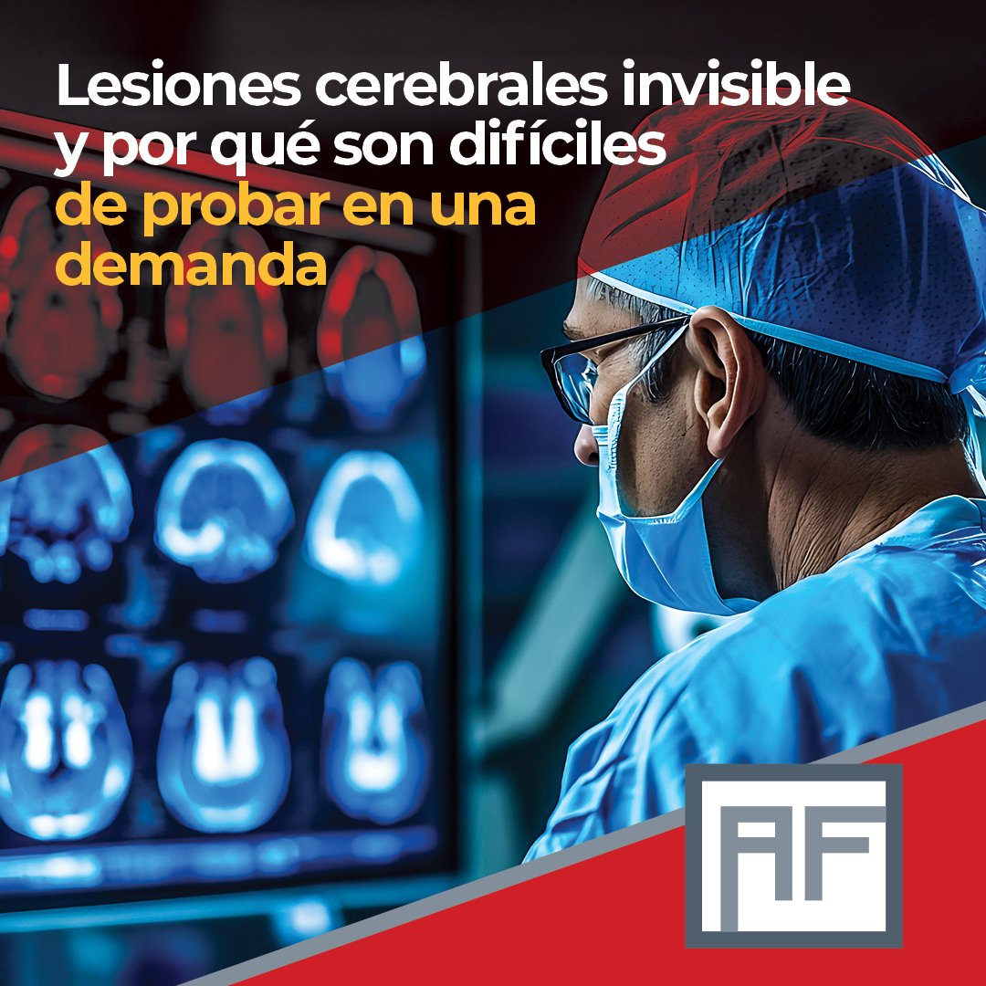 Abogado De Lesiones Cerebrales En Los Ángeles