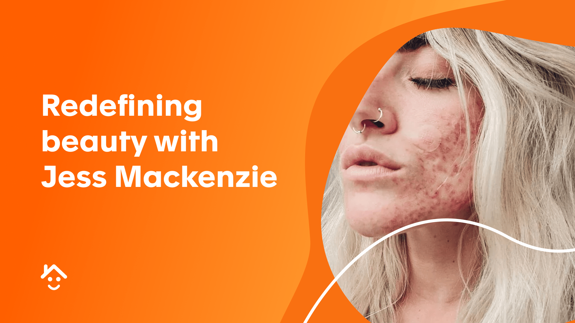 Redefining beauty with Jess Mackenzie