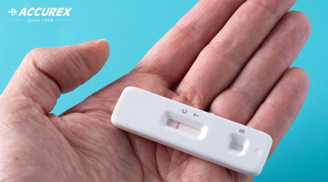 Rapid Diagnostic Test