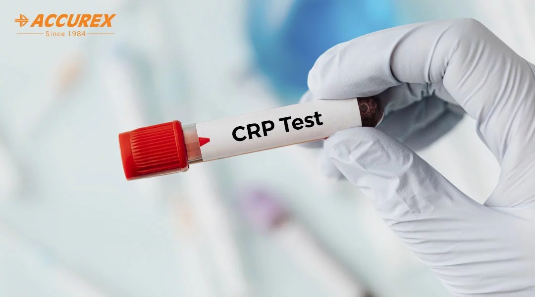CRP-Test