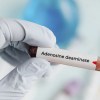 Adenosine deaminase