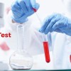 HbA1c Test