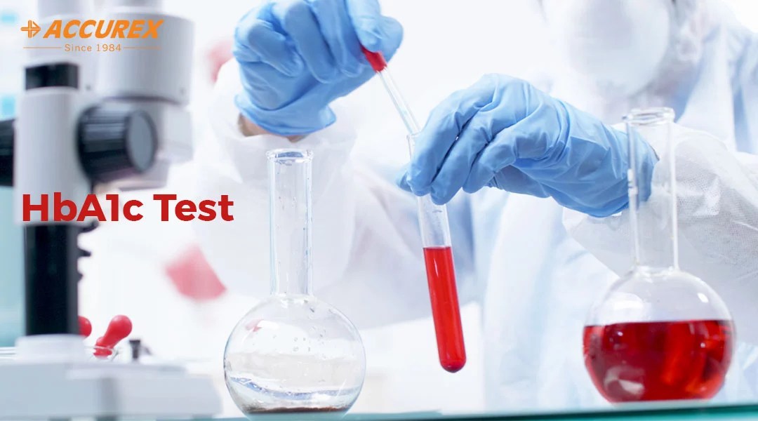 HbA1c Test
