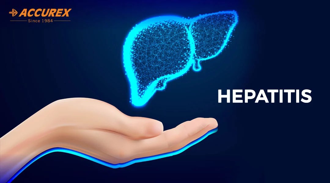 Hepatitis