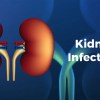 Kidney Infections