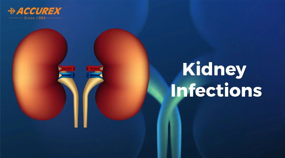 Kidney Infections