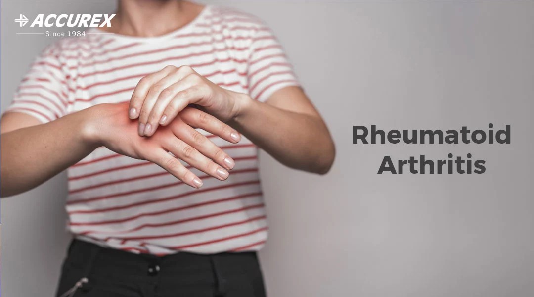 Rheumatoid Arthritis