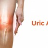Uric Acid