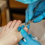 Uñas Encarnadas y Otros Dolores de Pie: Causas, Tratamientos y Prevención