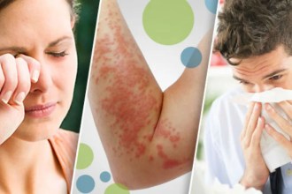 ¿Por qué se producen las alergias? Descubre las 10 alergias más comunes y sus sorprendentes causas