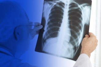 Top 10 razones por las que la radiografía es vital para el diagnóstico médico: Revelando lo invisible para salvar vidas