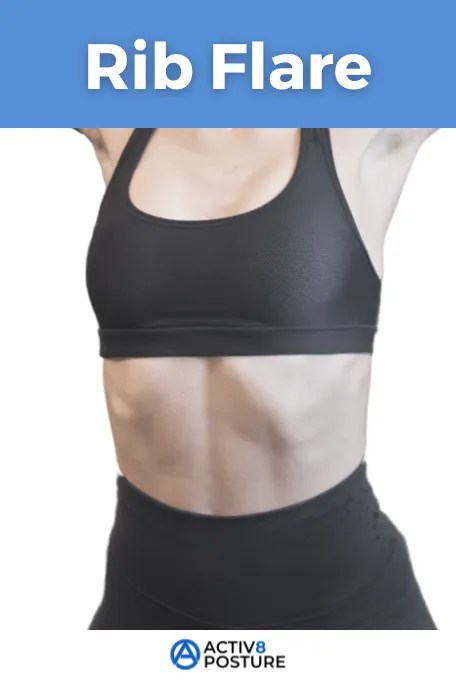 rib flare posture