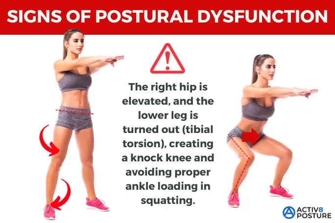postural dysfunction during squatting