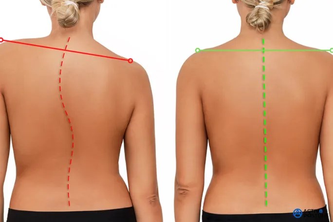 improve your posture