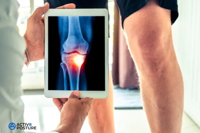 avoid knee surgery
