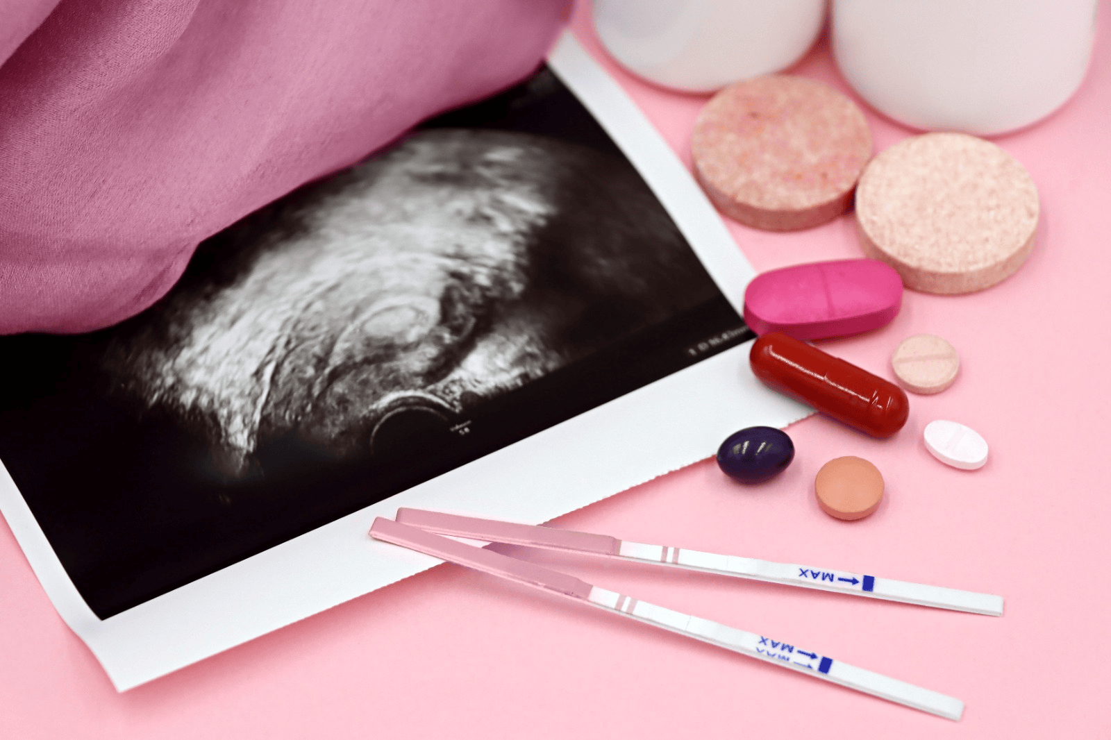 Ultrasound photo, ovulation test strips, and supplements for ovulation tracking with PCOS