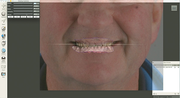 Jan 03, 2020 · i made a mockup in inventor 2022.2 to illustrate things for you (see attached), but there is still lots of work on weldments and frame trimming/joints to be done: 3d Printed Mock Up Used For Same Day Smile Makeover November December 2020 Compendium