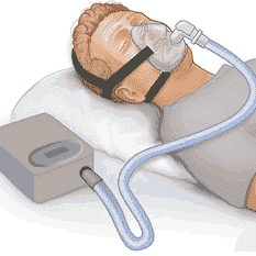 Medical Devices