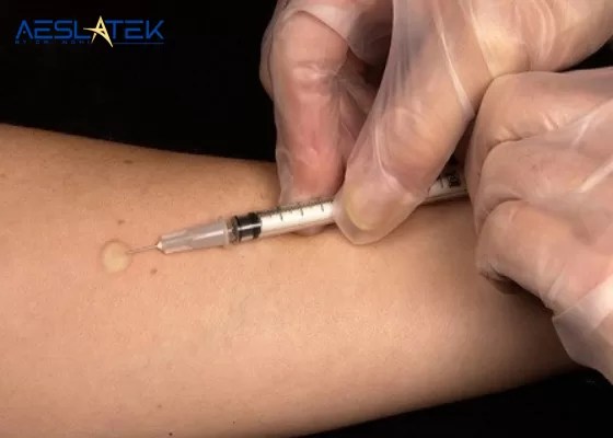 Nên lựa chọn các cơ sở uy tín để tiêm sẹoNên lựa chọn các cơ sở uy tín để tiêm sẹo