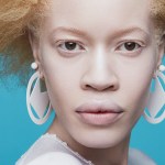 Mujeres negras albinas: representación y dignidad