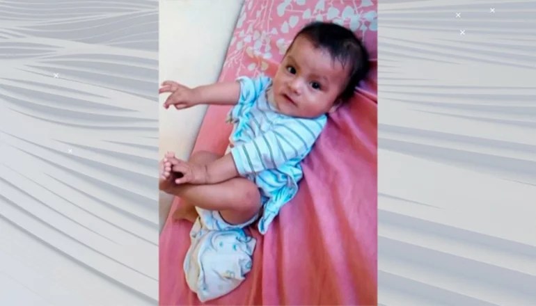 Bebé tuvo fiebre alta y no reacciona tras convulsionar