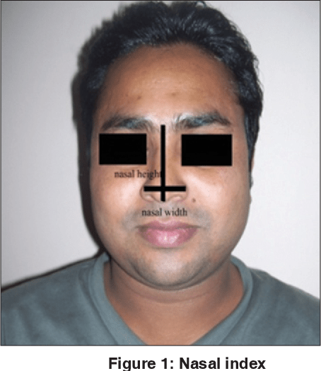 Figure 1 from anthropometric study of nasal index among the population of western uttar pradesh