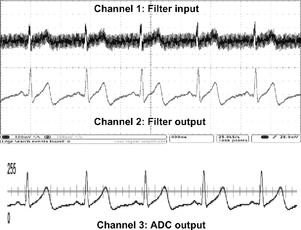 Low Power Analog Integrated Circuits For Wireless Ecg Low Power Analog Integrated Circuits For Wireless Ecg