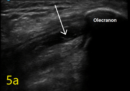 Ultrasound in Orthopedic Practice | The Scan