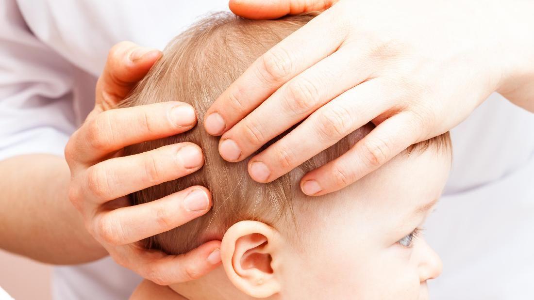 Penjelasan Dokter tentang Benjolan di Kepala Bayi