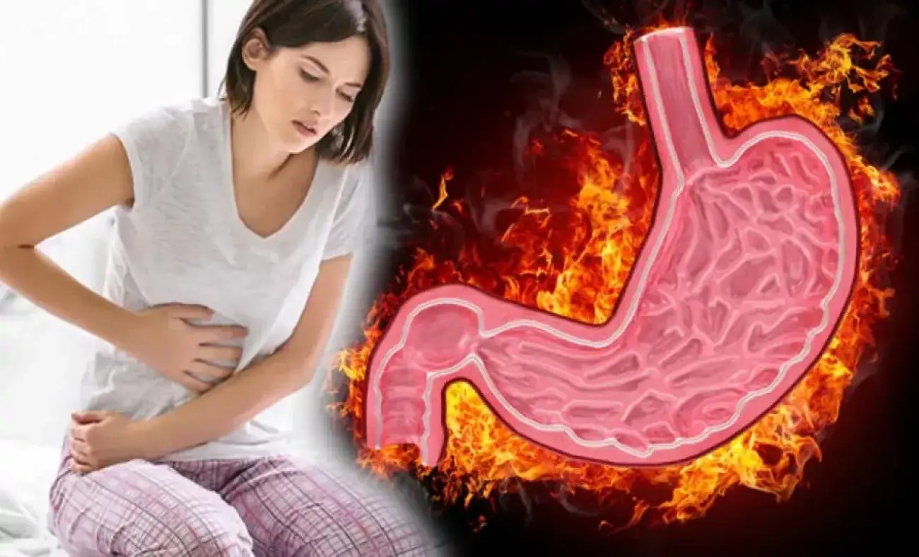 Gastrit tedavisi için 14 doğal ürün reçetesi📝👍
